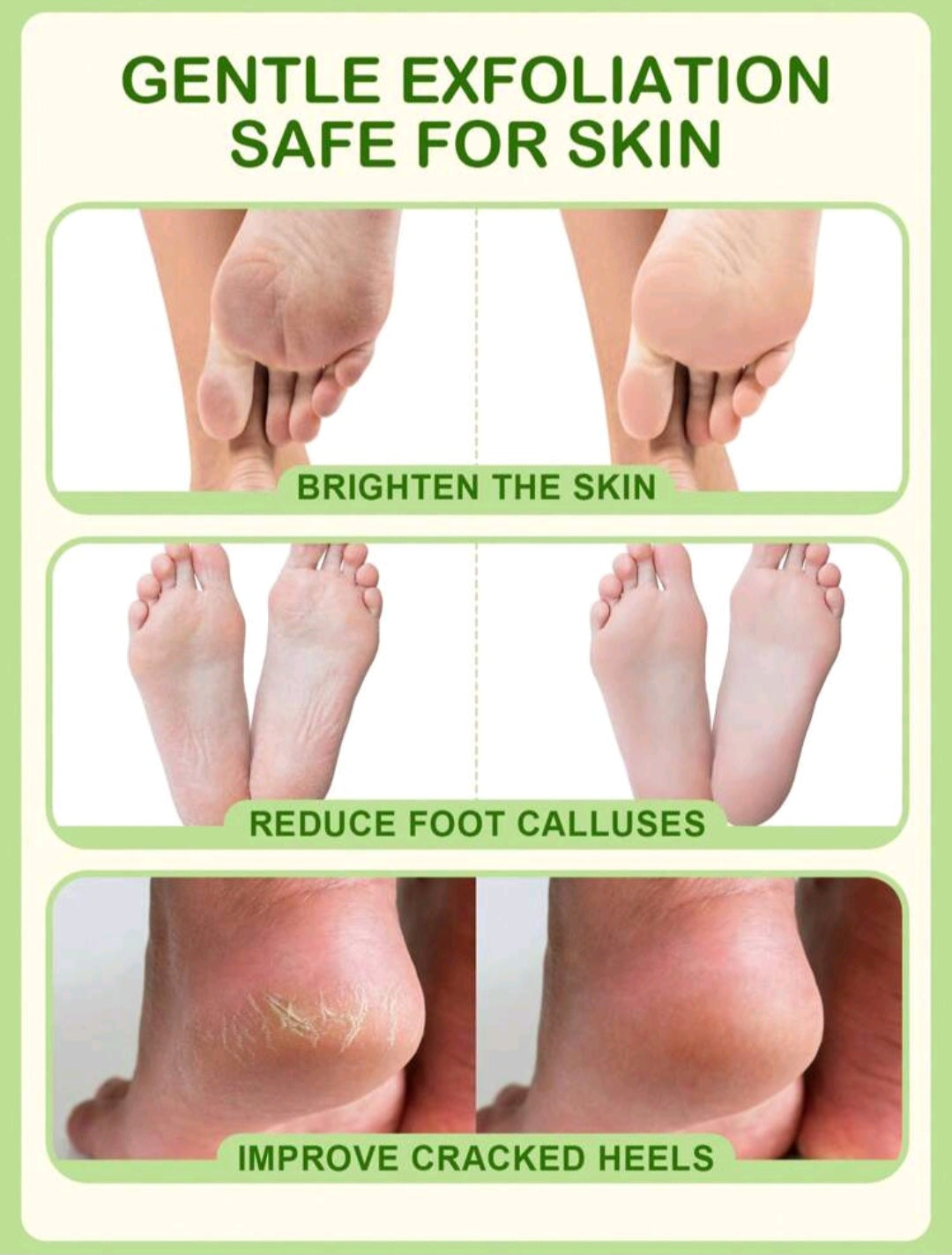 Peel-off Foot Mask